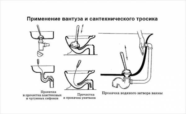 Как прочистить унитаз от засора бутылкой, содой, тросом