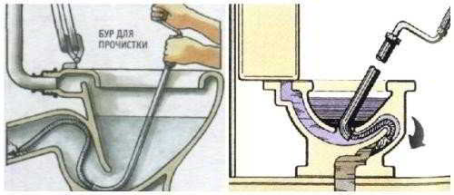 Как прочистить унитаз от засора бутылкой, содой, тросом